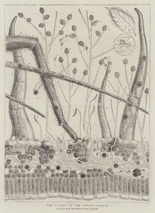 ジャガイモ病の真菌 作： Walter Granville Smith